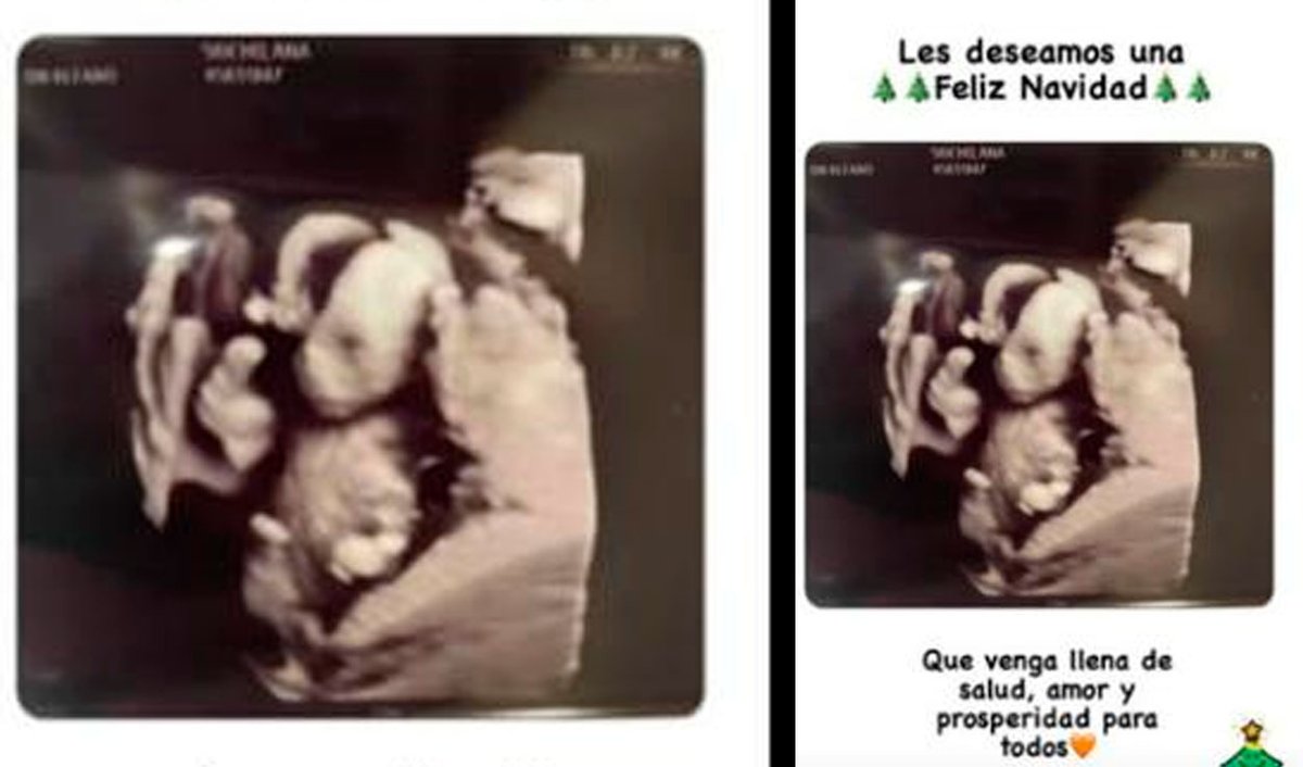 Edison Flores y Ana Siucho muestran la primera ecografía de su bebé. IG: <a href="/ana_siucho53/">Ana Siucho</a>