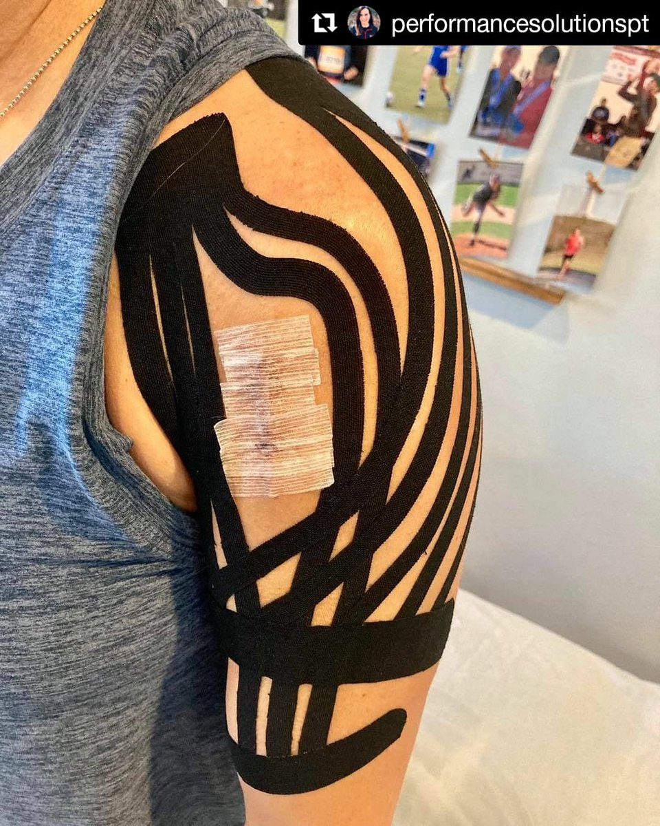 KinesioTape's tweet photo. #Repost @performancesolutionspt
Flushing out #swelling & pain following surgical removal of a benign nodular fasciitis. Helped @ehollern recover quicker & get back to her workouts #kinesiotape #kinesiotaping #cktp #lymphaticdrainage #kinesio #recovery #painrelief #tapewithwisdom https://t.co/CfwHsKXJqJ