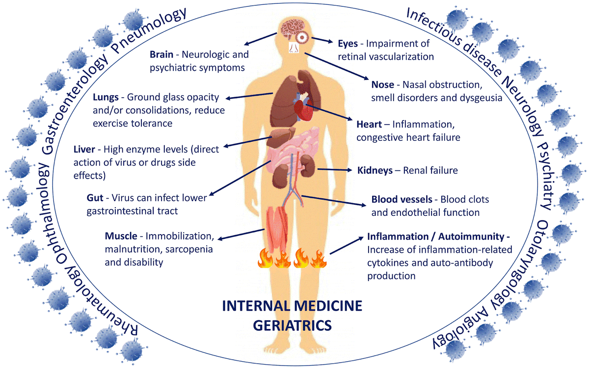 1/22 fil  #LongCovid  #apresj20  #apresj90  #COVIDー19 Les poumons sont l’organe cible de l'infection par le SRAS-CoV-2, et facteur pronostic évident.MAIS le virus peut se propager à de nbx organes :le cœur, les vaisseaux sanguins, les reins, l'intestin et le cerveau ...