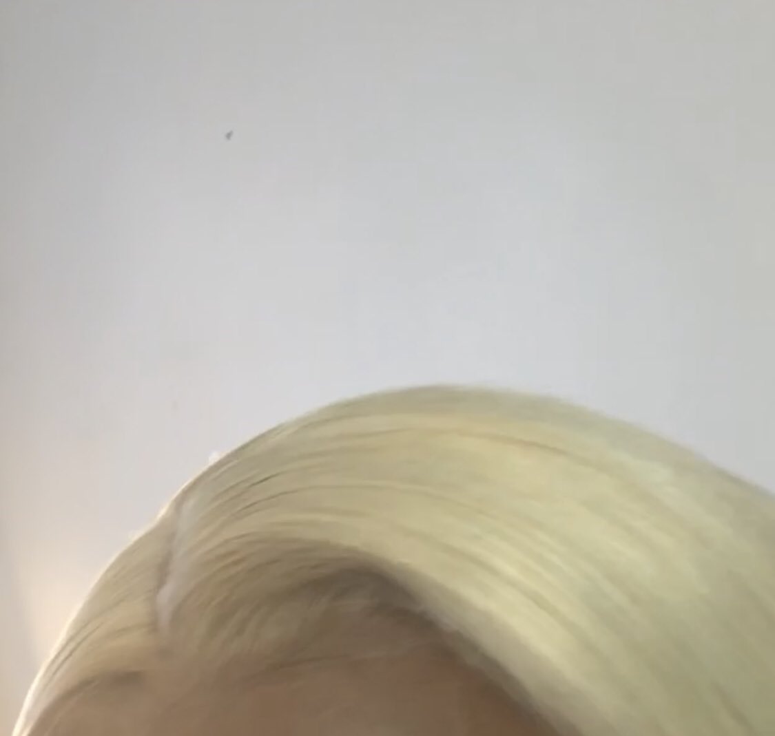 3. EXHIBIT A of shedding/poor quality. This unit is hair from a popular hair vendor and the frontal lasted a mere 3 weeks