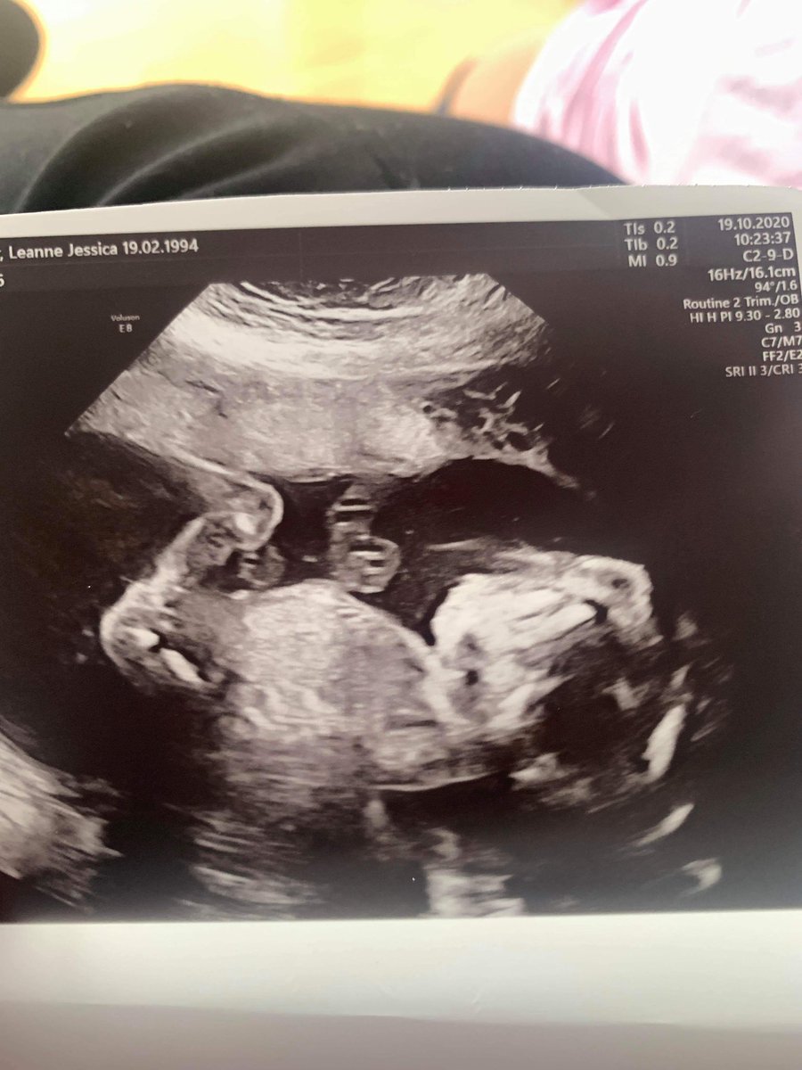 So only 9weeks left till baby M is due 😄👶🏻🌸