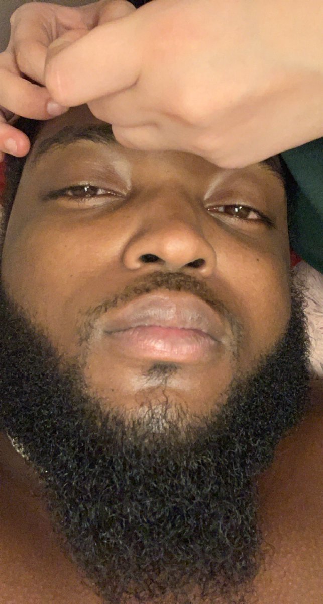 MagicalDoobie's tweet image. She always wants to pick at my bumps 

#pimplepoppers