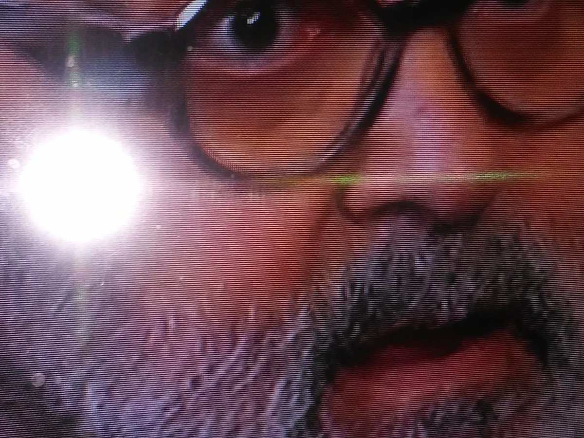 elpollodelafe's tweet photo. #lanataenrm que le sale a lanata de la.nariz ?😳 https://t.co/5sjqY3YME1