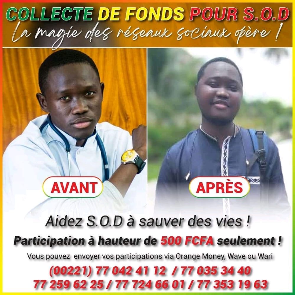 Ce jeune médecin a sauvé des vies, mobilisons-nous pour sauver la sienne. On dit qu'il faut 280 millions pour le soigner à Paris. C'est à notre portée. Donnons. À <a href="/Bouganegueye/">Bougane Gueye Dany</a> <a href="/YoussouNdourSN/">YOUSSOU NDOUR</a> <a href="/mamoudou_ibra/">Mamoudou Ibra Kane</a> il faut un telethon pour sauver ce médecin. Avec l'aide de Dieu.