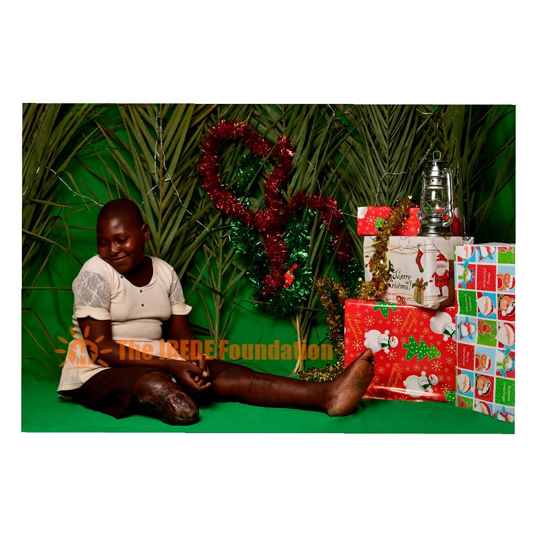 theirede's tweet photo. And Patience is smiling with the hope of walking again soon!

Thank you for your kind donations, she's grateful.

Let's get the complete funds before the end of the year 🙏🏾

#YetAnotherSmile
#ForPatience
#This2020 https://t.co/2OGM1IZKCu