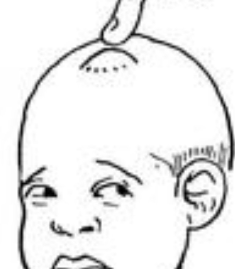 Anne Njom Nlend Sur Twitter Maman Tu T Inquietes Pour La Fontanelle Cet Espace Mou Sur La Tete De 2 Situations Doivent T Inquieter 1 La Fontanelle Bombee En Dehors Des Cris Va Anne Njom Nlend Sur Twitter Maman Tu T Inquietes Pour La Fontanelle Cet Espace Mou Sur La Tete De 2 Situations Doivent T Inquieter 1 La Fontanelle Bombee En Dehors Des Cris Va