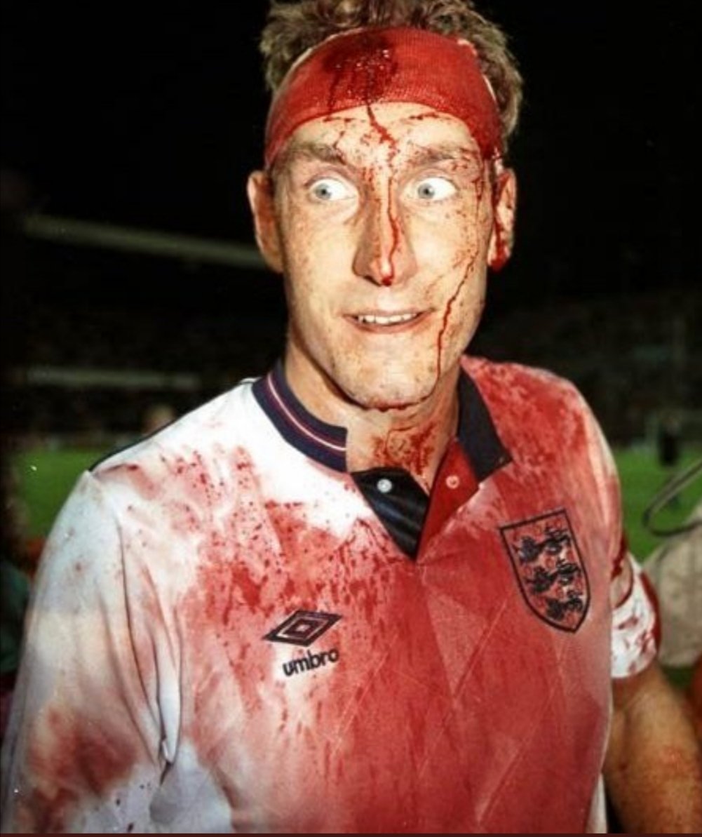 ... you should see the other guy!

Happy Birthday Terry Butcher 