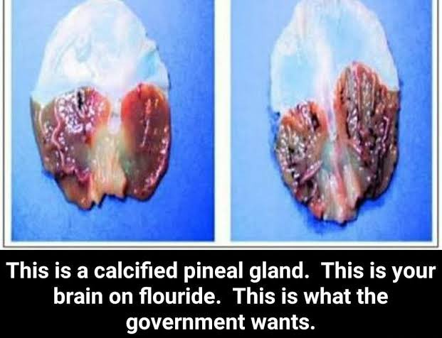 Ancients KNEW all about the pineal gland and the POWER that comes with activating it.Today in 21st century, there is a plot to SUPPRESS this.FLUORIDE (proven to LOWER IQ) is pumped all throughout our water supply to CALCIFY and render your pineal gland asleep and useless.