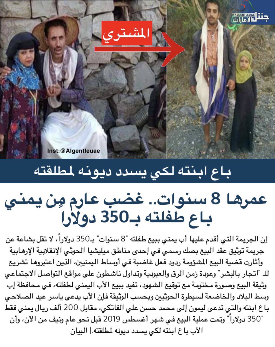 _abdullaah11's tweet photo. وقفة مع كل مشاهير سناب اليمن✍
واذنبهم اشغلو انغسهم بالسعودية 
بكل شاردة وواردة 
ممكن تطلعون مرجلتكم الان وتثبتون أنكم رجال
مع بيع هذي الفتاة التي تم بيعها باليمن ٣٥٠$ https://t.co/8sbgqy5NQ4