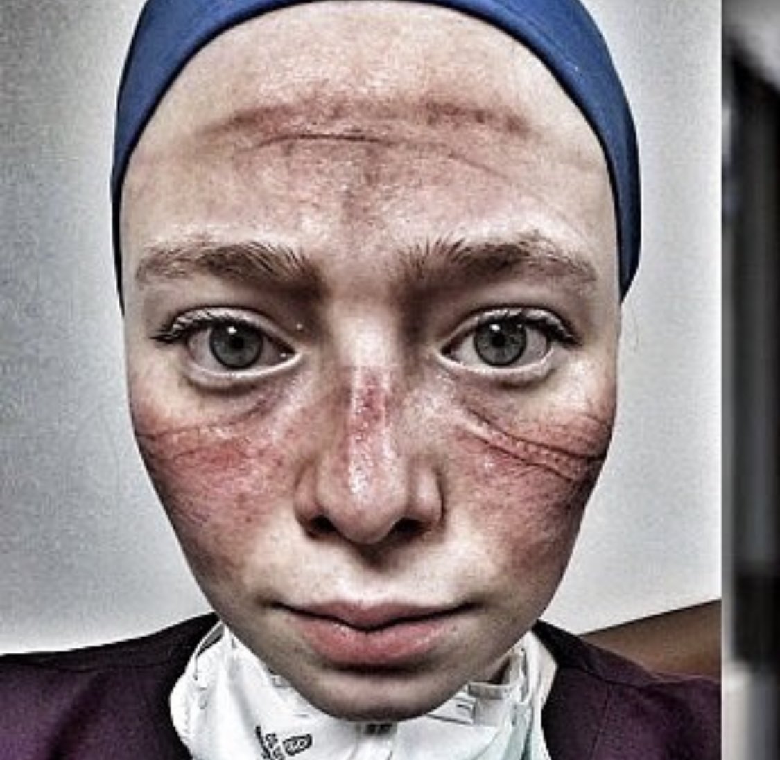 2020’nin en unutulmaz iki fotoğrafı; 

1. Covid olan babasına refakat ederken hastane bahçesinde online ders anlatan Mehmet hoca.

2. Covid servisinde yüzü bu hale gelen Seher hemşire.