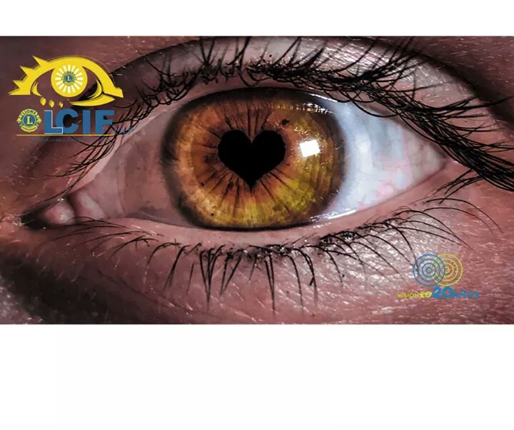 LCIFOBSON's tweet photo. No olvides mantener tus #ojos hidratados e ingerir alimentos ricos en vitamina A. https://t.co/OJz9Kbl4ZX