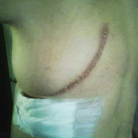 pieces and somehow try to heal over the unimaginable. Not every lung issue is covid. Not everything is a conspiracy. Rest in Peace Jon aka Brodie Lee. You're legacy was an awesome one. My heart goes out to the family.