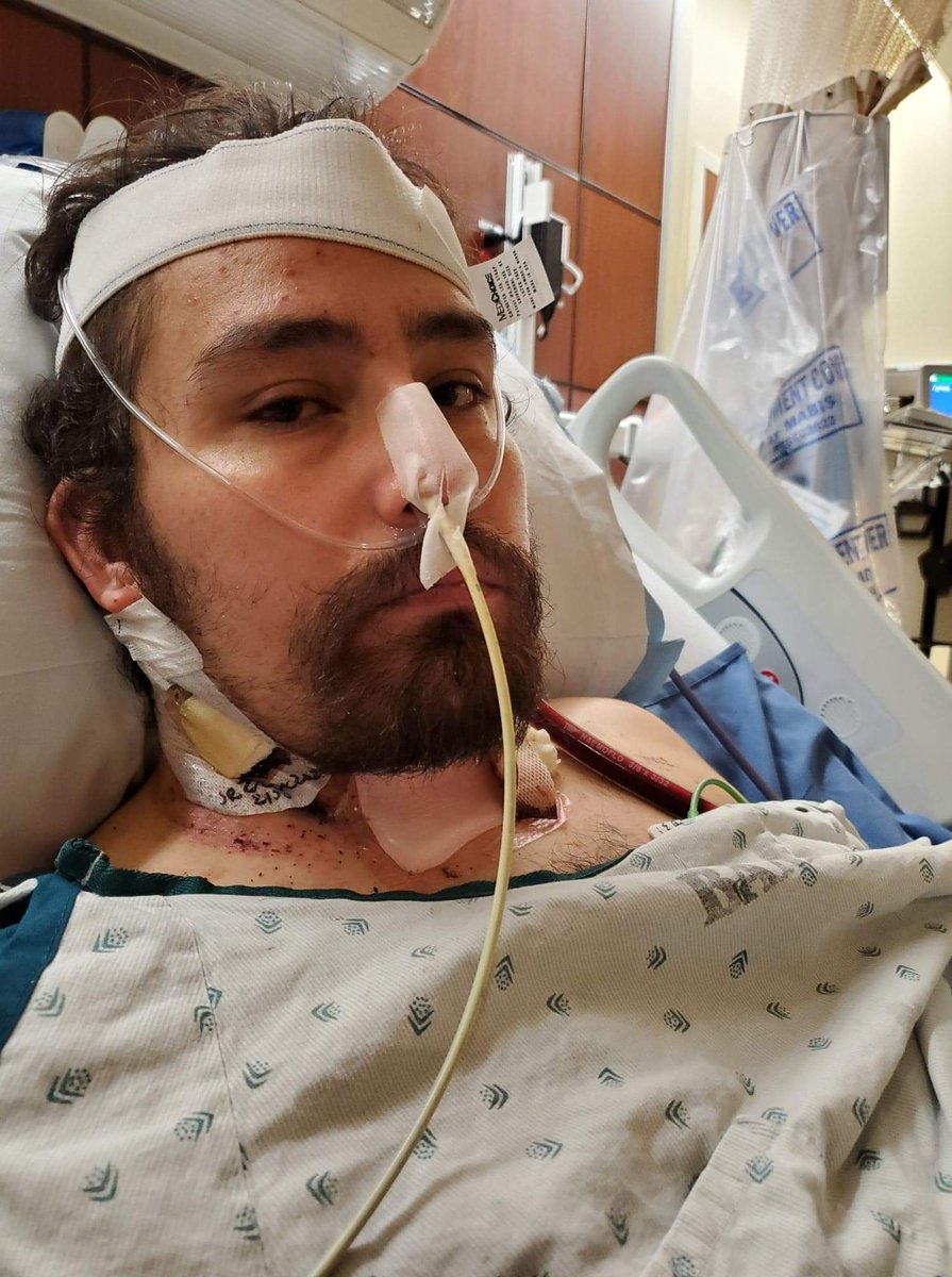 A video of Andrew walking today.