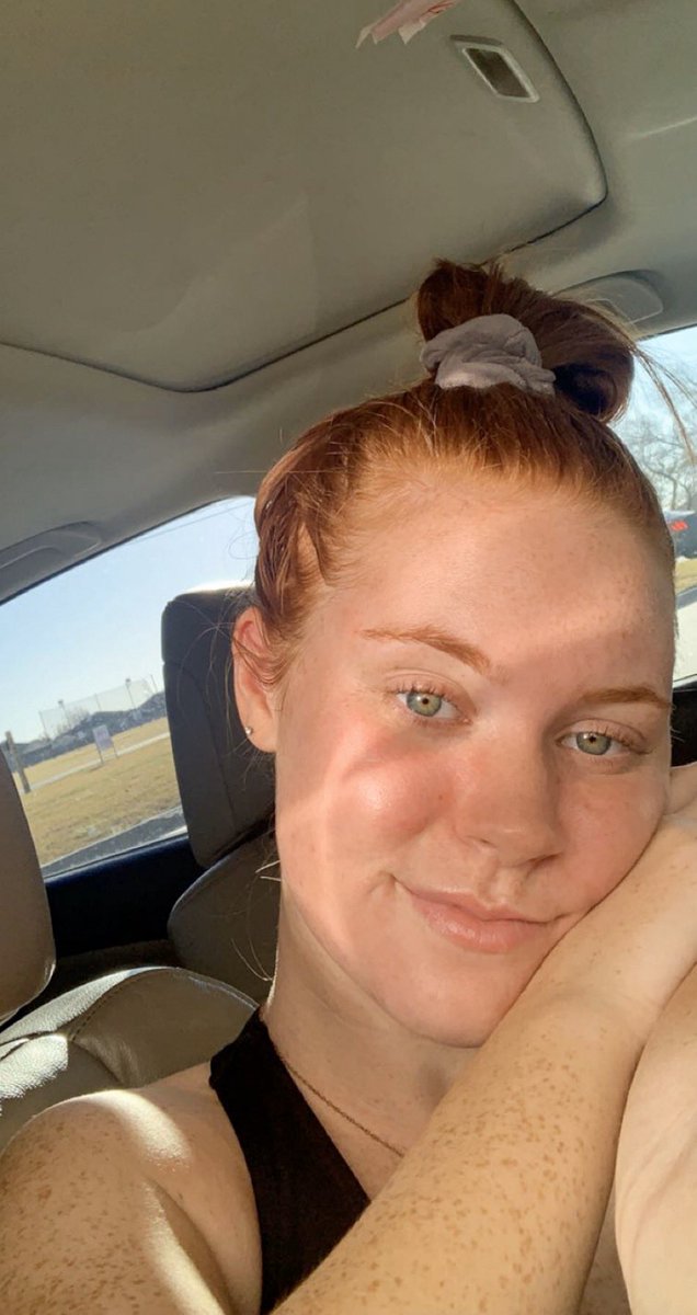 dirty hair but fresh face