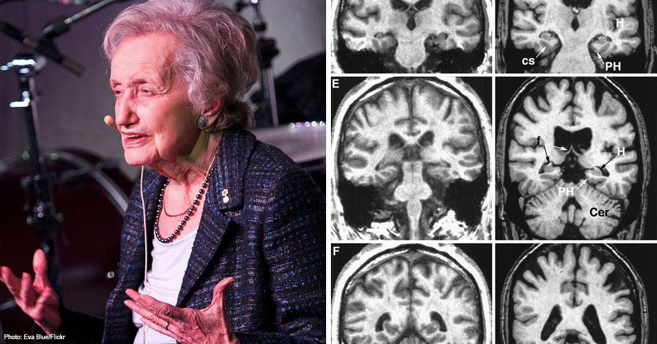 Oldplparecool's tweet photo. “Meet 102-year-old Dr. Brenda Milner — a pioneering neuroscientist who's breaking new ground in her 70-year long career as a brain researcher!” #gerotwitter @linkedsenior https://t.co/gN7YU59P0M https://t.co/C7wmNDjqQd