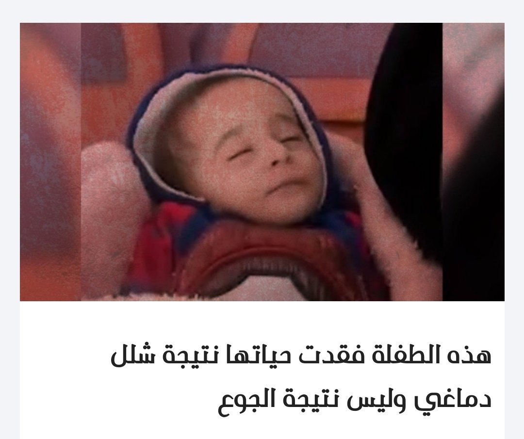 للتوضيح فقط
اني نشرت عن هاذه الطفلة لتبيان وعندما يقسم الله لك الرزق ولو في جوف الأرض ستخذه و عندما تشكي قلت الحال استعن بالله وليسا بلمواقع التواصل عندما يعتمد الا نسان على غير الله فقد زل