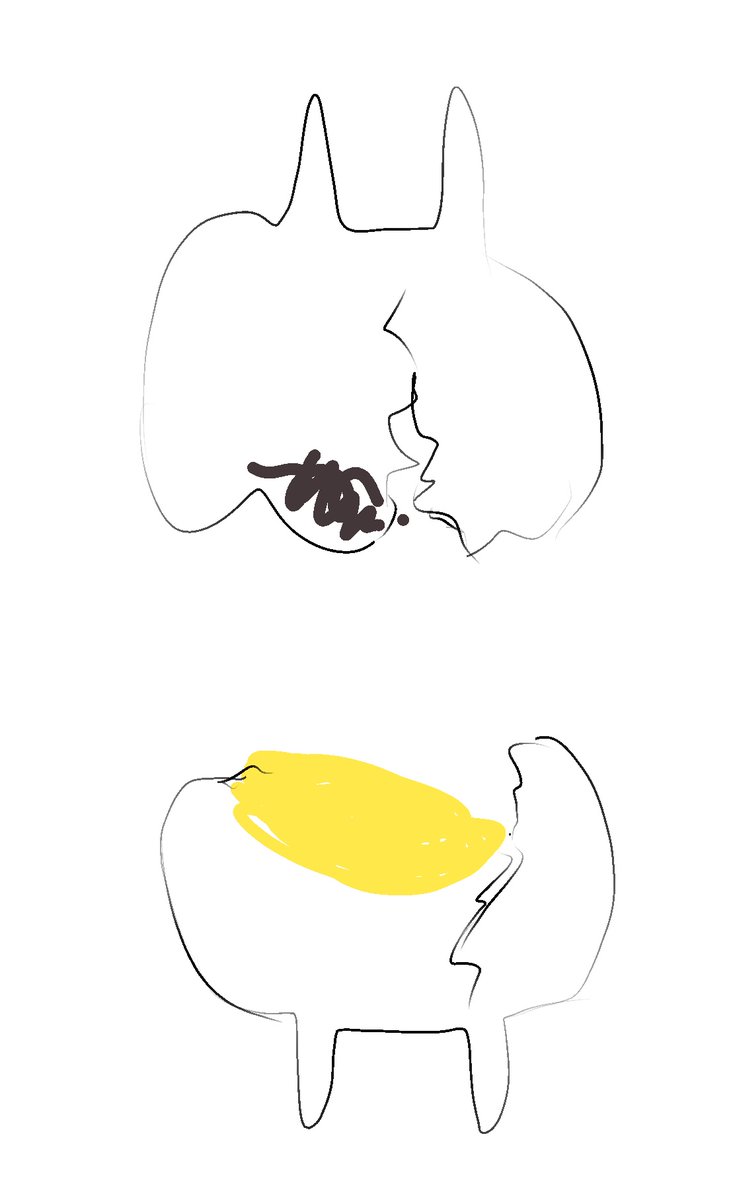 heres my shitty phone scribble of whats wrong 

the yello is my filling it popped out & is now at an angle buried into the soft inside of my tooth & the deeper part of the slant is Cracked
and there's a tooth above it with a cavity that is cracked in the same placet 