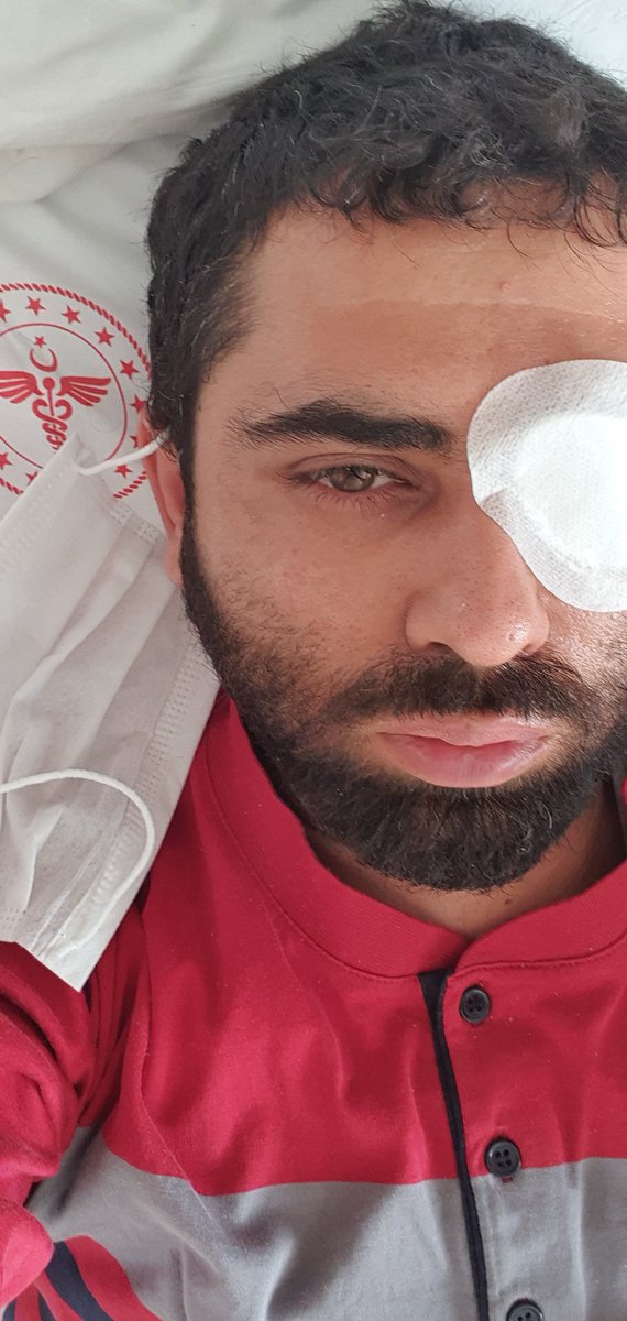 01CELEBI's tweet photo. Sn twitter da bulunan khk mağduru kaderdaslarim çalıştığım işyerinde iş kazası sonucu sol gözümde hasar var 1 operasyon geçirdim 2.operasyon geçireceğim odama bağlı görme kaybı var çok DUAYA ihtiyacım var siz sevgili khk ailesinden... https://t.co/6XfgrXmCzb