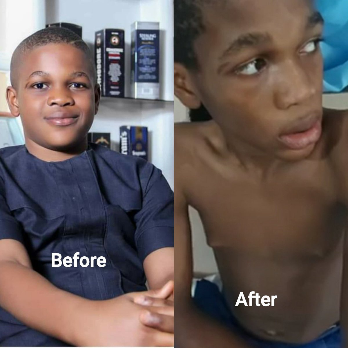 volqx's tweet image. If not for the scar on this young mans face I would never have belived he was the same person. Yes most of us went to boarding schools but some of us haven’t been able to confront/communicate our sufferings, Don Dave is us. Let’s join forces! #JusticeForDonDavis