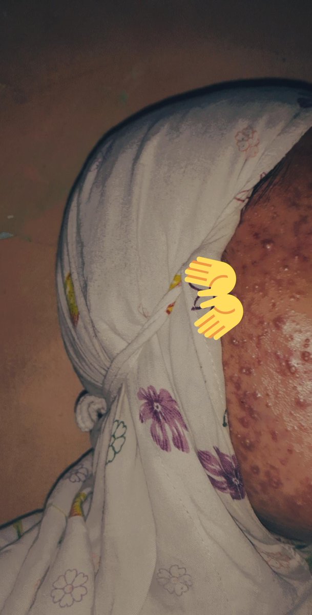 yahalouu's tweet image. sad bgt wajahku jdi parah gini.. 🥺