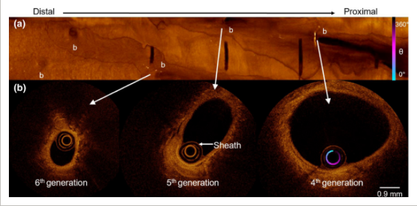 International Respiratory Muscle Collaborative (@irespmuscollab) on Twitter photo Awesome demonstration of some new technology for imaging airway morphology in awake humans by Peters et al: physoc.onlinelibrary.wiley.com/doi/full/10.14…
#Work_of_breathing #irmc #RespiratoryPhysiology <a href="/ThePhySoc/">The Physiological Society</a> <a href="/yannickmolgat/">Yannick Molgat-Seon</a> Awesome demonstration of some new technology for imaging airway morphology in awake humans by Peters et al: physoc.onlinelibrary.wiley.com/doi/full/10.14…
#Work_of_breathing #irmc #RespiratoryPhysiology <a href="/ThePhySoc/">The Physiological Society</a> <a href="/yannickmolgat/">Yannick Molgat-Seon</a>
