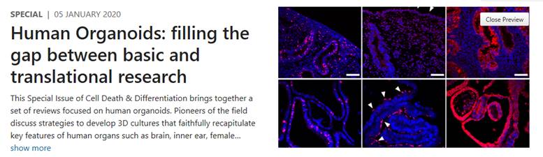 This Special Issue of #CellDeathDifferentiation brings together a set of reviews focused on human #organoids. Pioneers of the field discuss strategies to develop 3D cultures that faithfully recapitulate key features of human organs! Have a look! 

go.nature.com/2LoAYw1