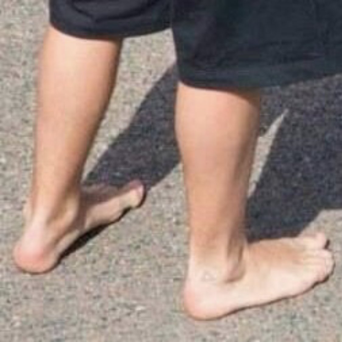 louis tomlinson’s ankles: a thread