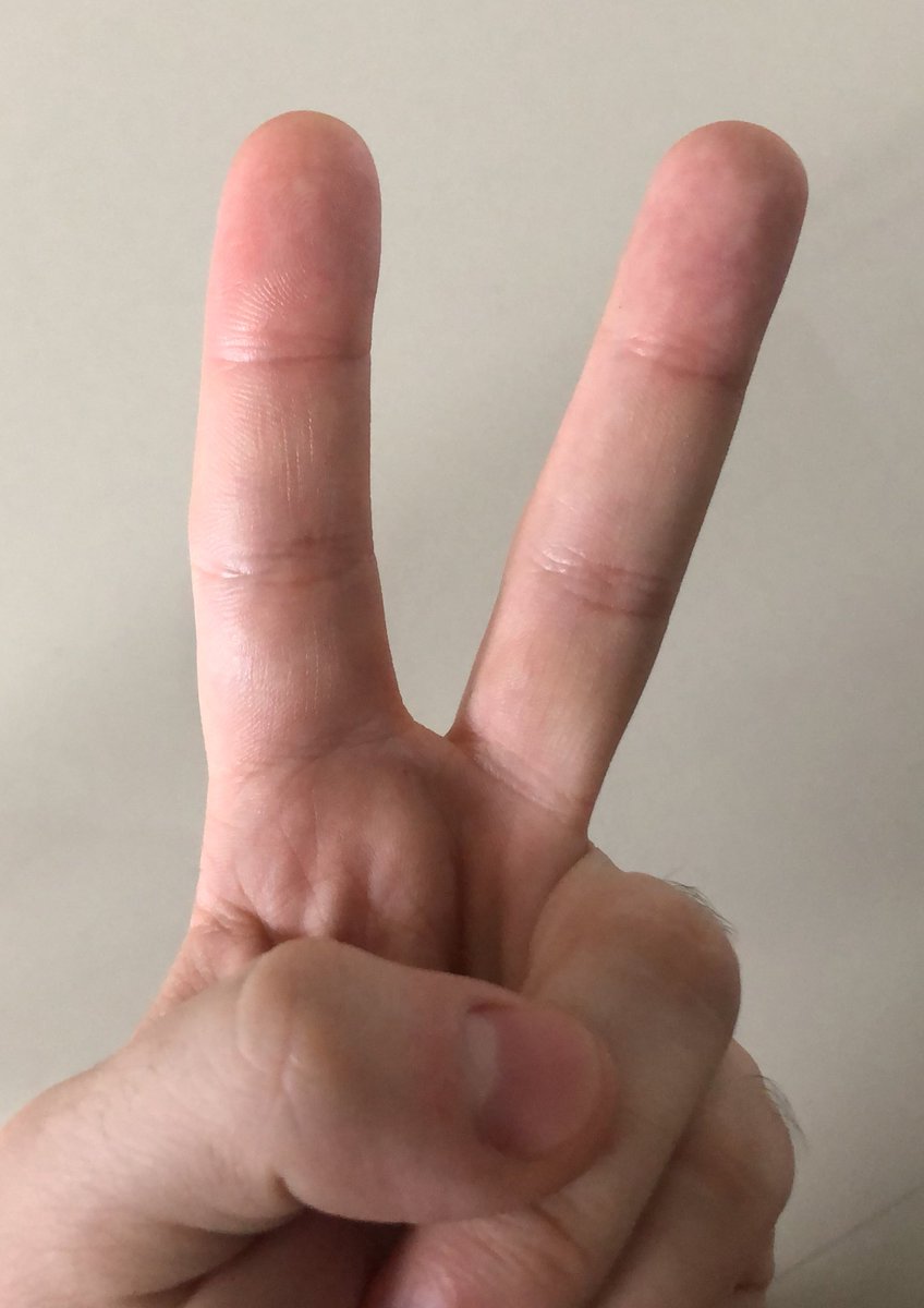 Is it easy to tell if I'm raising 1 or 2 fingers?