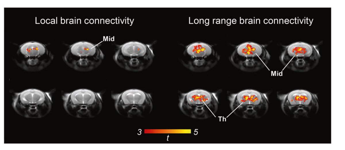 (d) As muscarinic agent have putative antipsychotic properties, we also mapped the effect of the NMDAR antagonist phencyclidine (PCP) on brain connectivity (note that PCP is a ketamine analogue). We found that PCP increases long-range connectivity in thalamus-PFC-hippocampus 5/7