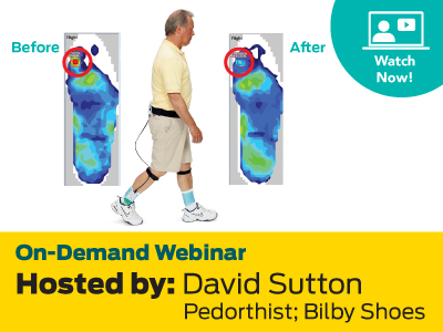 TekscanMedical's tweet photo. David Sutton, a certified pedorthist and clinical advisor, shares a case study covering his strategy for offloading a patient suffering from a four-year reoccurring diabetic ulcer, using F-Scan as a critical method to verify his decisions. https://t.co/xHXKCq4IA1 https://t.co/nvWFGjuiJd