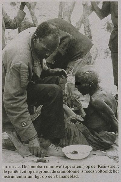 Global_Folder's tweet photo. Kenyan Kisii people began the surgery art long before colonialism. They had ‘Omobari Omotwe’ (head surgeon) as the lead surgeon in any head related injuries. https://t.co/ODwSn4OQcO