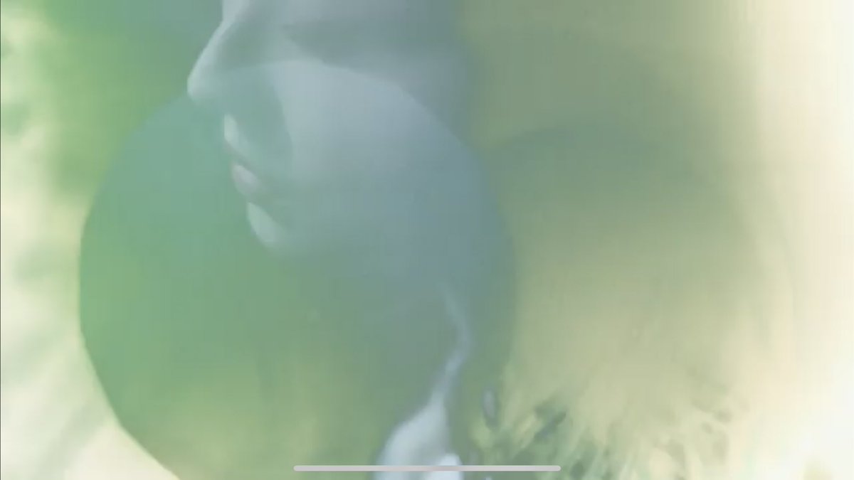 I KNOW THIS NOSE THIS IS OUR BABY HASEUL