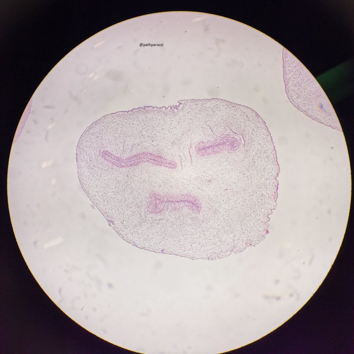 Pathparazzi's tweet photo. Mood for 2020. #pathology #histology #pursedlips #umbilicalcord https://t.co/7dkCEBx7WJ
