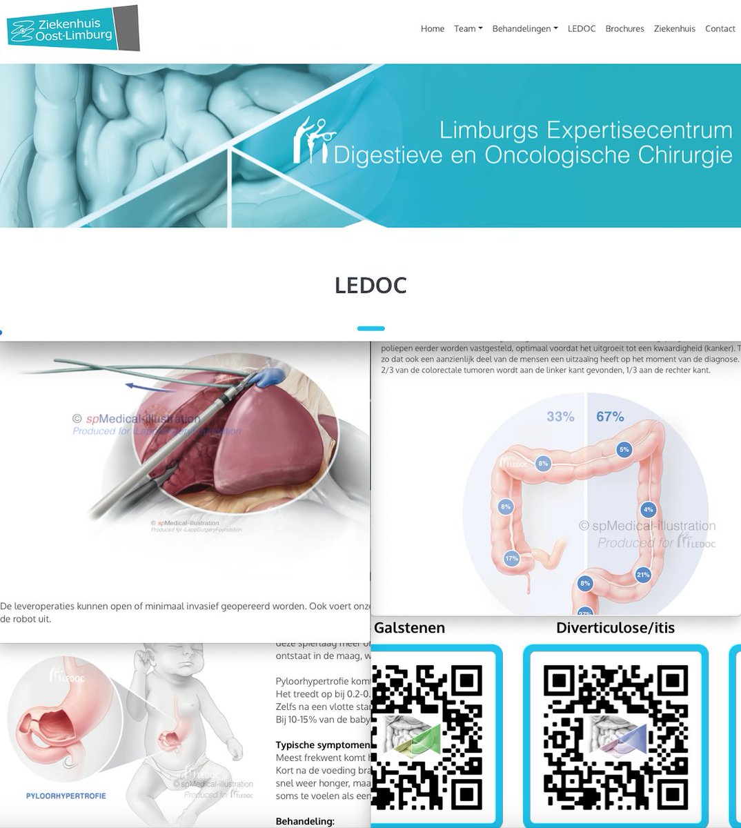 Joep Knol MD, PhD (@knoljoep) on Twitter photo Today launching our new informative website chirurgie-zol.be Lots of work of many <a href="/ZOLziekenhuis/">ZOL</a> <a href="/sp_Medical/">Stephanie Ph</a> <a href="/DLivemed/">DLivemed</a> Now only in flemish but you'll enjoy content anyway.. Also reunited with great friend <a href="/HondtMathieu/">Mathieu D’Hondt MD, PhD</a> who will join <a href="/DennisWicherts/">Dennis Wicherts</a> for MIS lever surgery! Today launching our new informative website chirurgie-zol.be Lots of work of many <a href="/ZOLziekenhuis/">ZOL</a> <a href="/sp_Medical/">Stephanie Ph</a> <a href="/DLivemed/">DLivemed</a> Now only in flemish but you'll enjoy content anyway.. Also reunited with great friend <a href="/HondtMathieu/">Mathieu D’Hondt MD, PhD</a> who will join <a href="/DennisWicherts/">Dennis Wicherts</a> for MIS lever surgery!