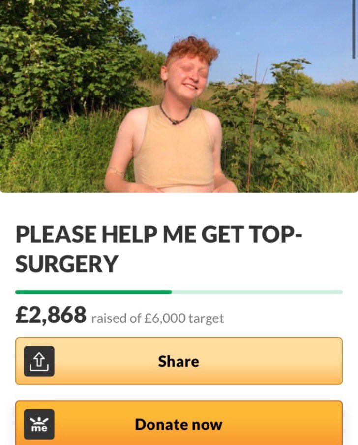 CAN YOU HELP ME GET TOP SURGERY??? Xxxxx

gofundme.com/f/azs-top-surg…

#topsurgery #TransIsBeautiful #TransRightsAreHumanRights
