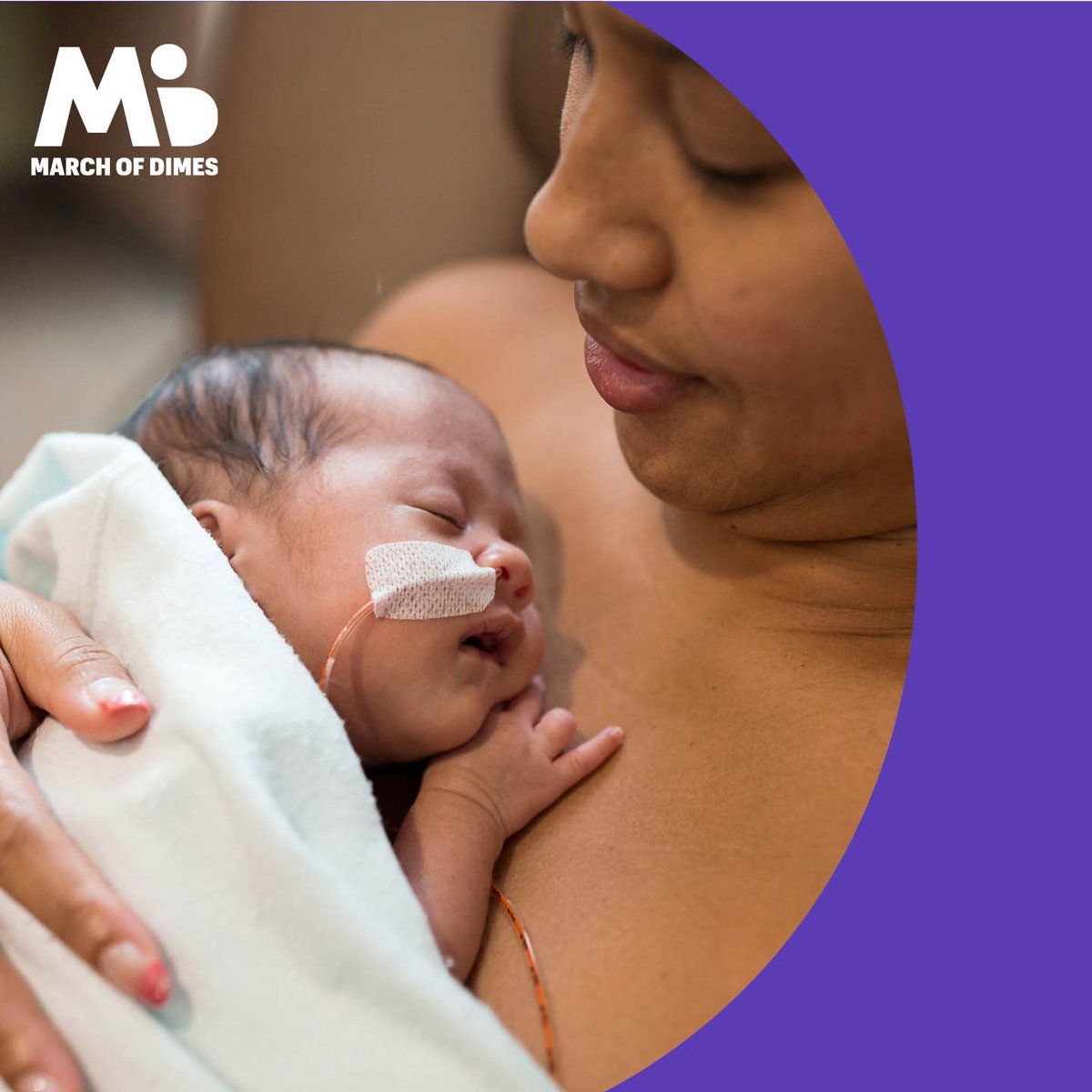 MarchofDimesLA's tweet photo. Premature birth and its complications are the largest contributors to infant death in the U.S. and globally. We won't stop fighting for the health of all moms &amp; babies. Join the fight to improve the health of every mom &amp; baby. https://t.co/WooTHTen8x #marchofdimes #MODwontstop https://t.co/19HHFE2mBT