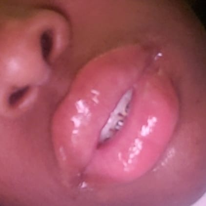 FetishItch's tweet photo. Like what you see? Can you imagine better?? Text me😉💋

 #fetish #fetishcommunity #biglips #sexylips #lipfetish #glossylips #braces #bracesfetish #liplover https://t.co/nxzpt9HX51