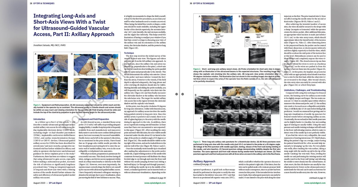 EPLabDigest's tweet photo. This week, we're counting down the top 5 most-read
@EPLabDigest articles published in 2020! The #3 most-read article was written by @50wattdoc and published in our August issue: https://t.co/pZVMFdnwS6 #EPeeps @DrBradleyKnight https://t.co/HOYvqsGI47