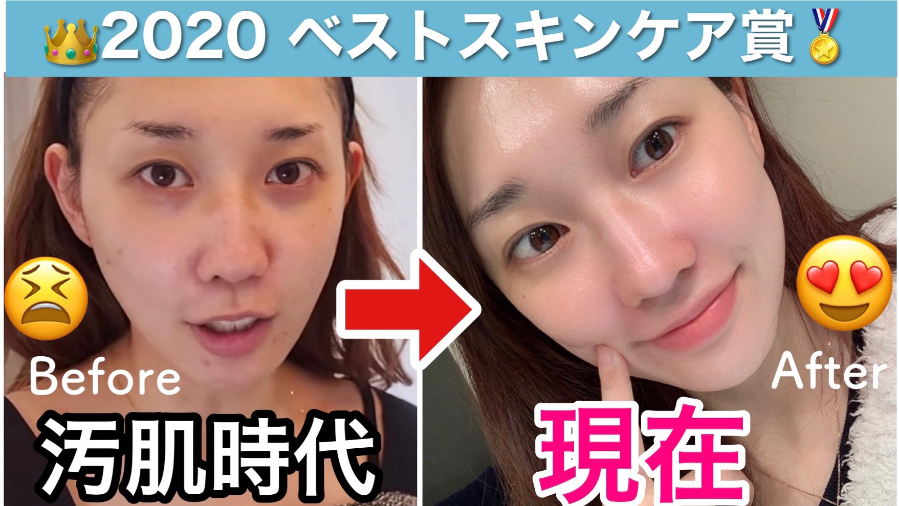 かじえり メイクの教科書発売中 汚肌 美肌へ 肌改善したベストスキンケア 毛穴ケア 角質ケア 透明感 T Co 3vkxkbgvte Youtubeより T Co Ss06than5v Twitter