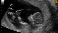 JohnArandia's tweet photo. 14 semanas de gestación, pensala hna (o). https://t.co/NalXVhZgjj