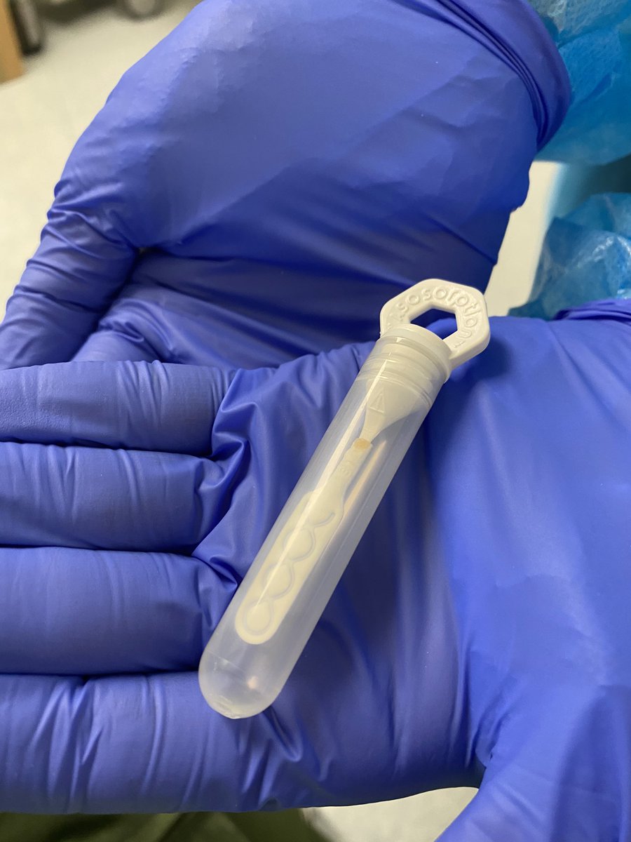 then THREE covid tests. two of the normal swab ones, which she did together. and then this weird nasal swab which doesn’t go as deep but has to be there for a whole (very long) minute. bonkers.