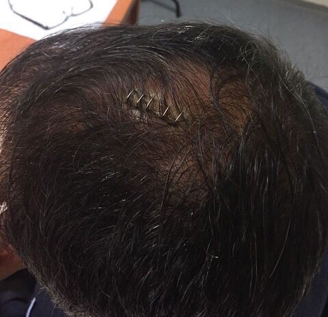 mrtgkm's tweet image. Olmayan kafayı yarmışız 😂Büyük kepazesiniz #8jk 😂😂🎱#yarık8jk