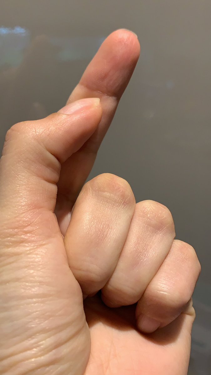  Step 5 continued:How much water? I’ve always stuck to my mums age old fool proof measurement. The water should go to one finger crease above the rice layer Right all set? Stick it on high heat and let it get to the boil, let it cook for about ten mins