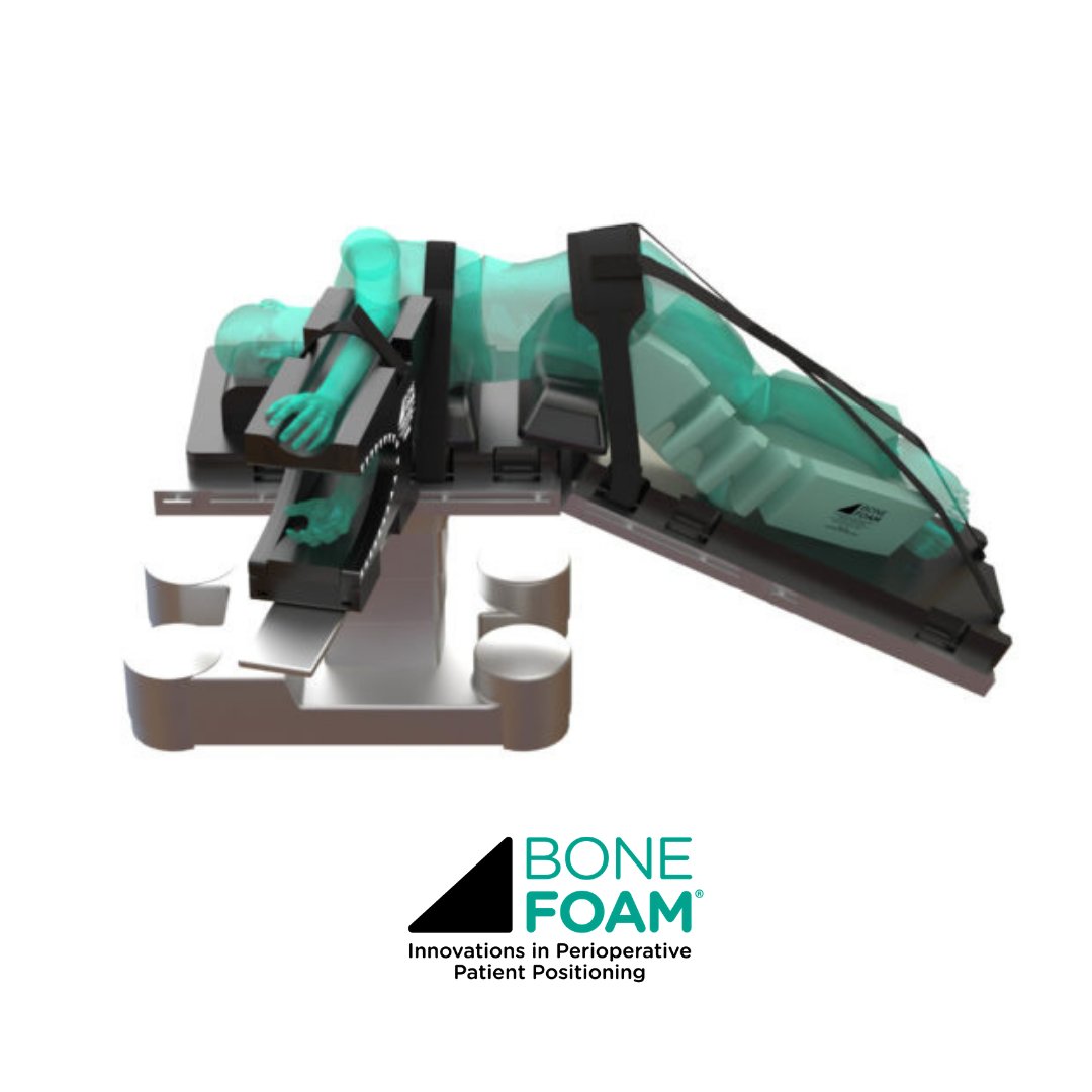 BoneFoam's tweet image. Make lateral positioning simple and reliable for all OR staff. The Sideline Positioning System improves surgical site access for lateral spine procedures. 

bonefoam.com/product/latera…

#surgerytools #ORtools #surgeryrecoverytips #safersurgery