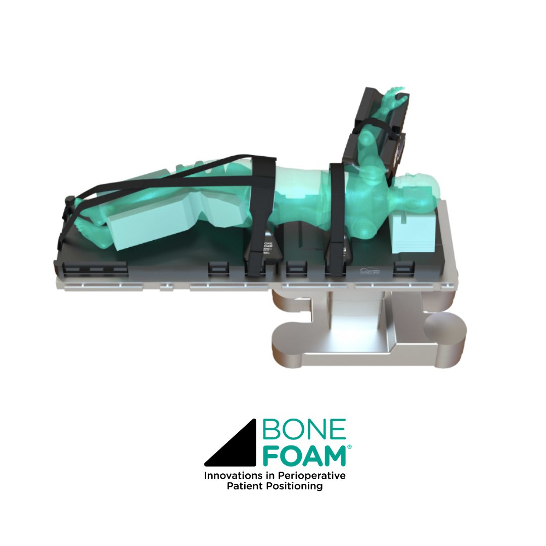 BoneFoam's tweet image. Make lateral positioning simple and reliable for all OR staff. The Sideline Positioning System improves surgical site access for lateral spine procedures. 

bonefoam.com/product/latera…

#surgerytools #ORtools #surgeryrecoverytips #safersurgery