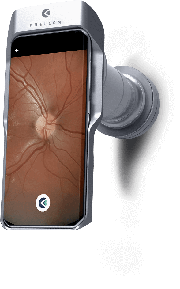 usophthalmic's tweet photo. Learn mor about the Eyer NM Top  :
🌐 https://t.co/4MkUzFG0kw 

☎️ If you want more information, 
📞+1 (888) 881-1122 
Visit us at: https://t.co/v8B74jrR1F Or write an email to marketing@usophthalmic.com with your name, phone number and country for an expert to contact you. https://t.co/jNLdAK2BtG