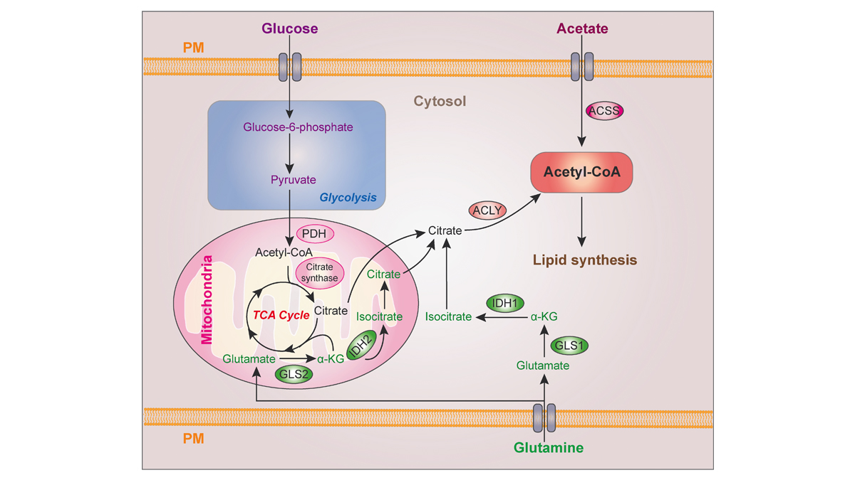 JExpMed's tweet photo. Lipid metabolism and cancer. #JEMCancerFocus Review from Xueli Bian, Zhimin Lu (@ZJU_China) and colleagues: https://t.co/ehfUn9of8P https://t.co/L70AtG3KX4