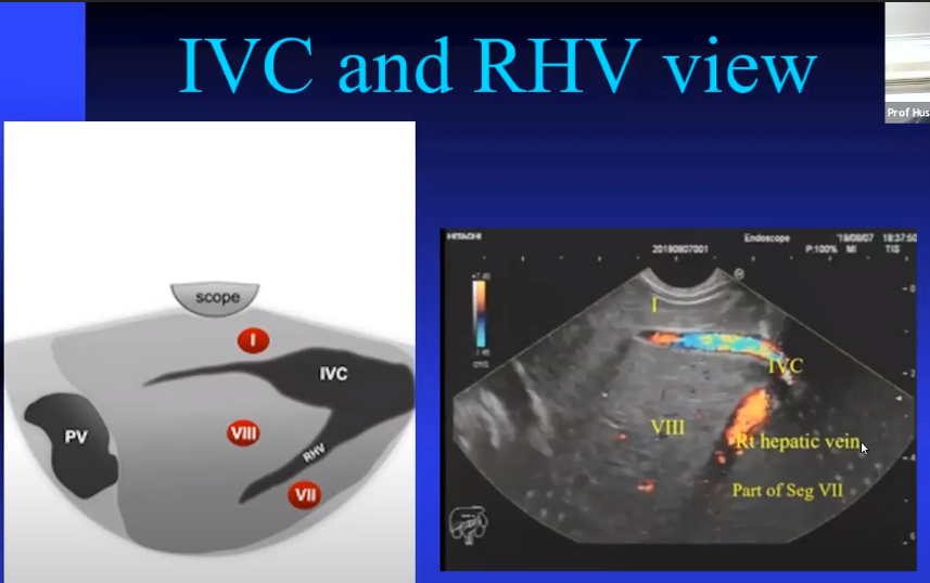 Rajan kanth tweet media