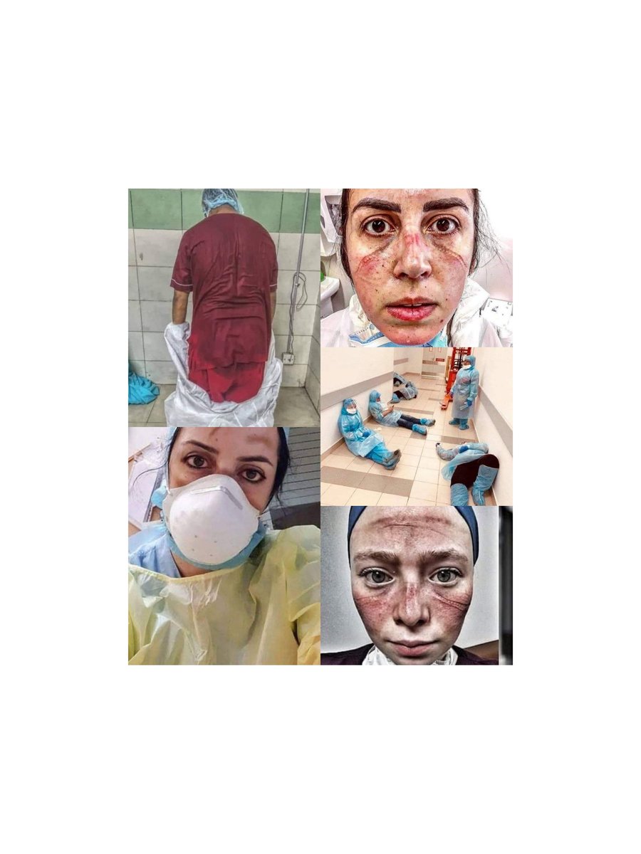 Bu emeğin karşılığı yüzde 30 bile olamaz ama büyüklük bizde kalsın.
#SağlıkçıyaYüzde30Zam