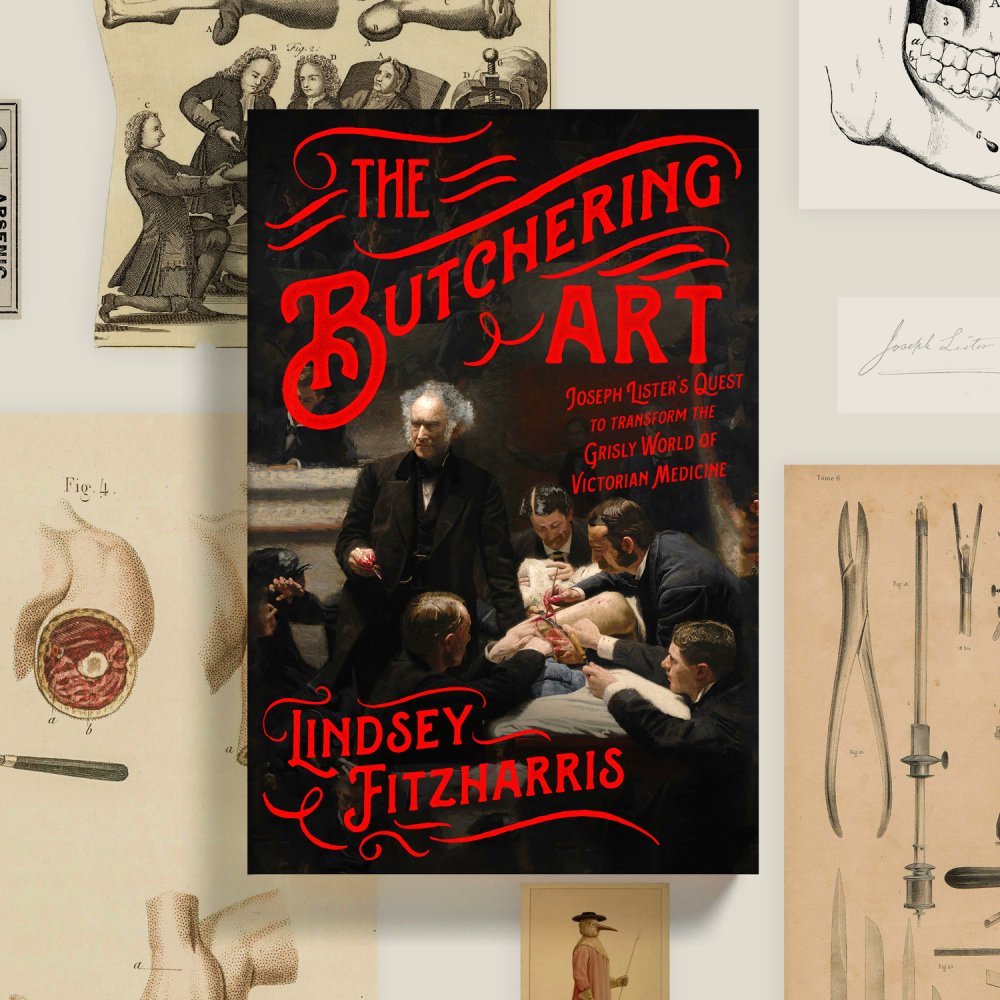(8/8) I hope you enjoyed this  #histmed thread! I can’t wait to share more of these stories with you. In the meantime, you can check out my first book  #TheButcheringArt, about the horrors of pre-anesthetic and pre-antiseptic surgery:  https://www.barnesandnoble.com/w/the-butchering-art-lindsey-fitzharris/1125780853?ean=9780374537968